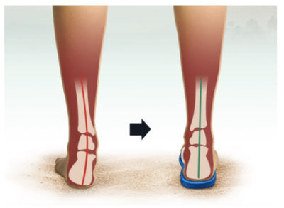 ARCHLINE Orthotic Thongs Arch Support Shoes Footwear Flip Flops Orthopedic - Black/Black - EUR 44