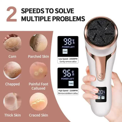 Black Electric Foot Callus Remover - Rechargeable Waterproof Pedicure Tool with Automatic Dead Skin Removal