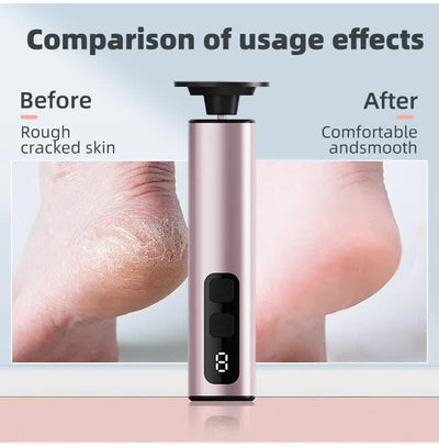 Black Rechargeable Electric Foot File with 9 Speed Settings - Callus Remover for Smooth Feet
