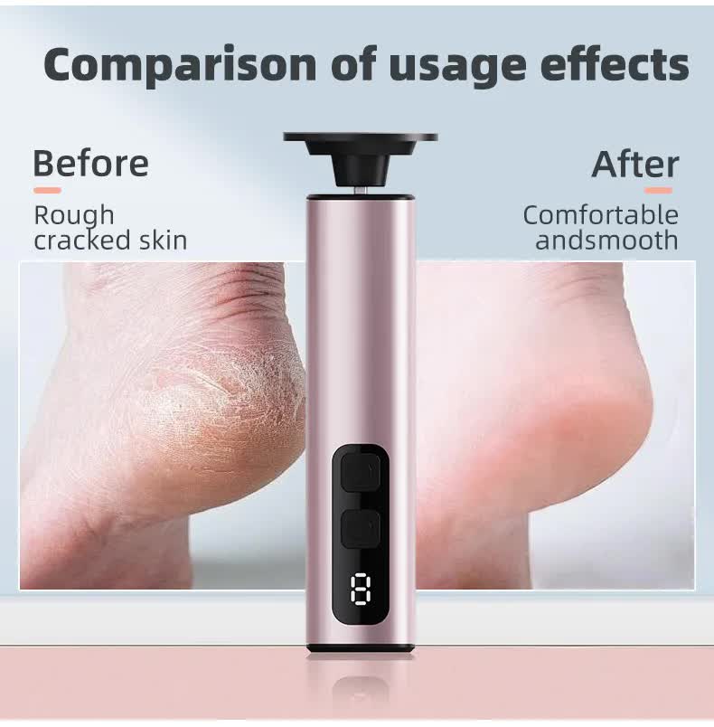 Black Rechargeable Electric Foot File with 9 Speed Settings - Callus Remover for Smooth Feet