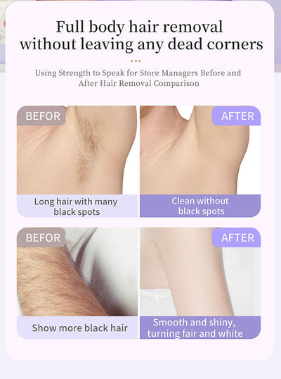 5-in-1 Electric Lady Shaver & Grooming Kit - LCD Display, USB-C Rechargeable, Full Body Hair Removal(Purple)